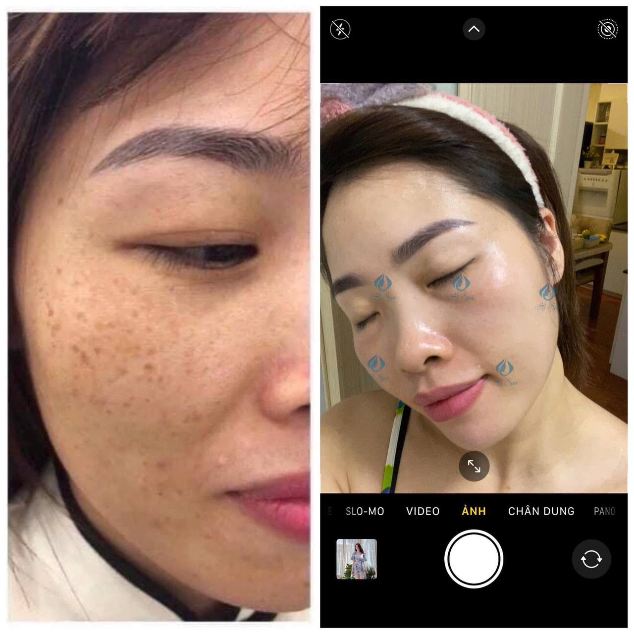 Không gian spa Hi Medical 13