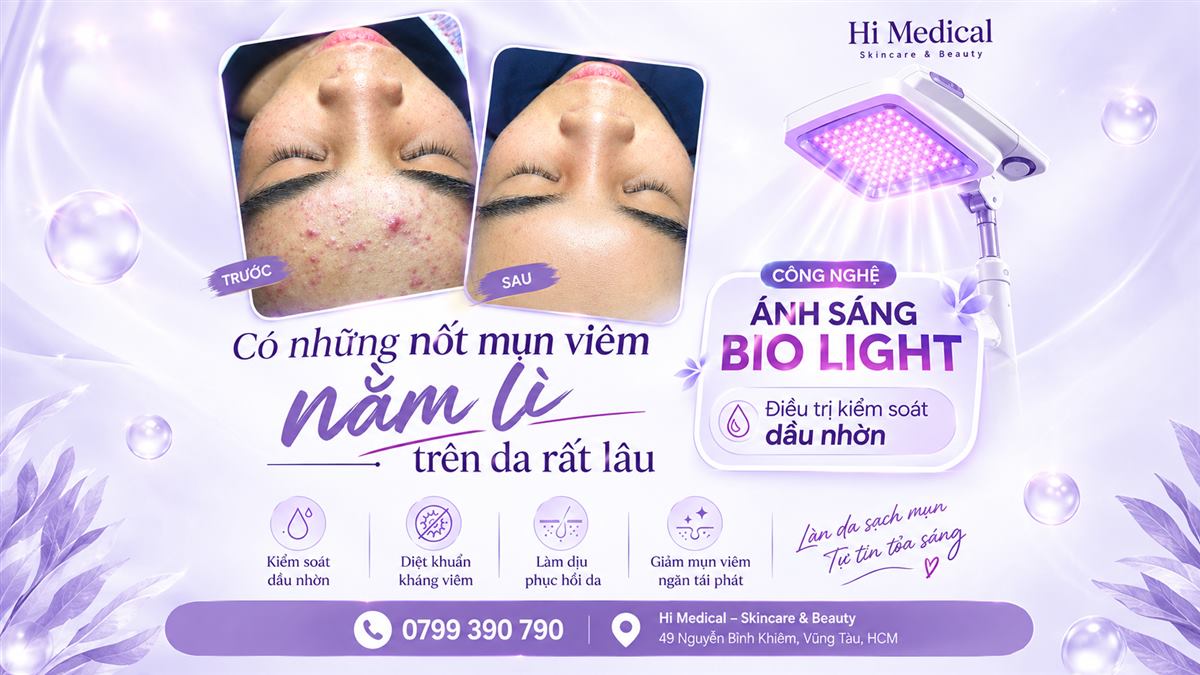 Trị nám da: nguyên nhân và cách điều trị hiệu quả 2026