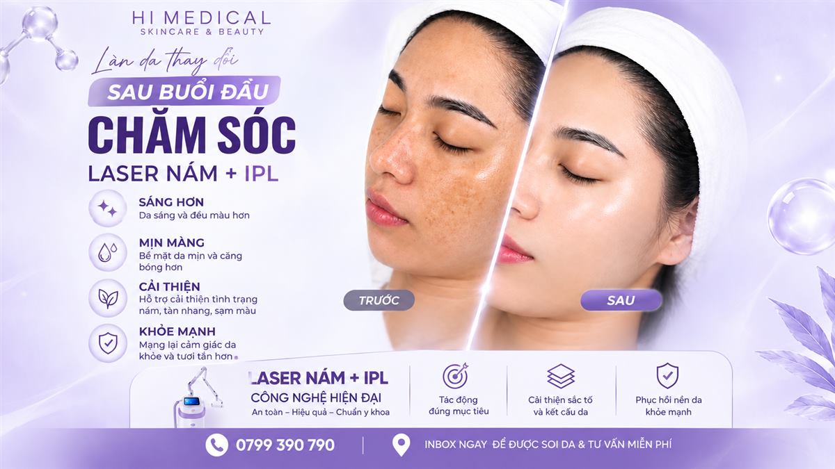 Hành trình xóa nám 3 tháng của chị Thu Hà: "Tôi đã tìm lại làn da trắng sáng sau 10 năm"